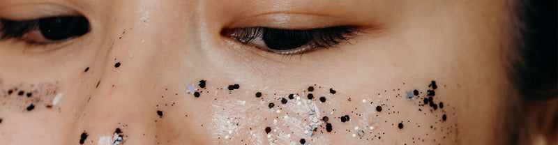 What are Blackheads + How to Extract Blackheads at Home