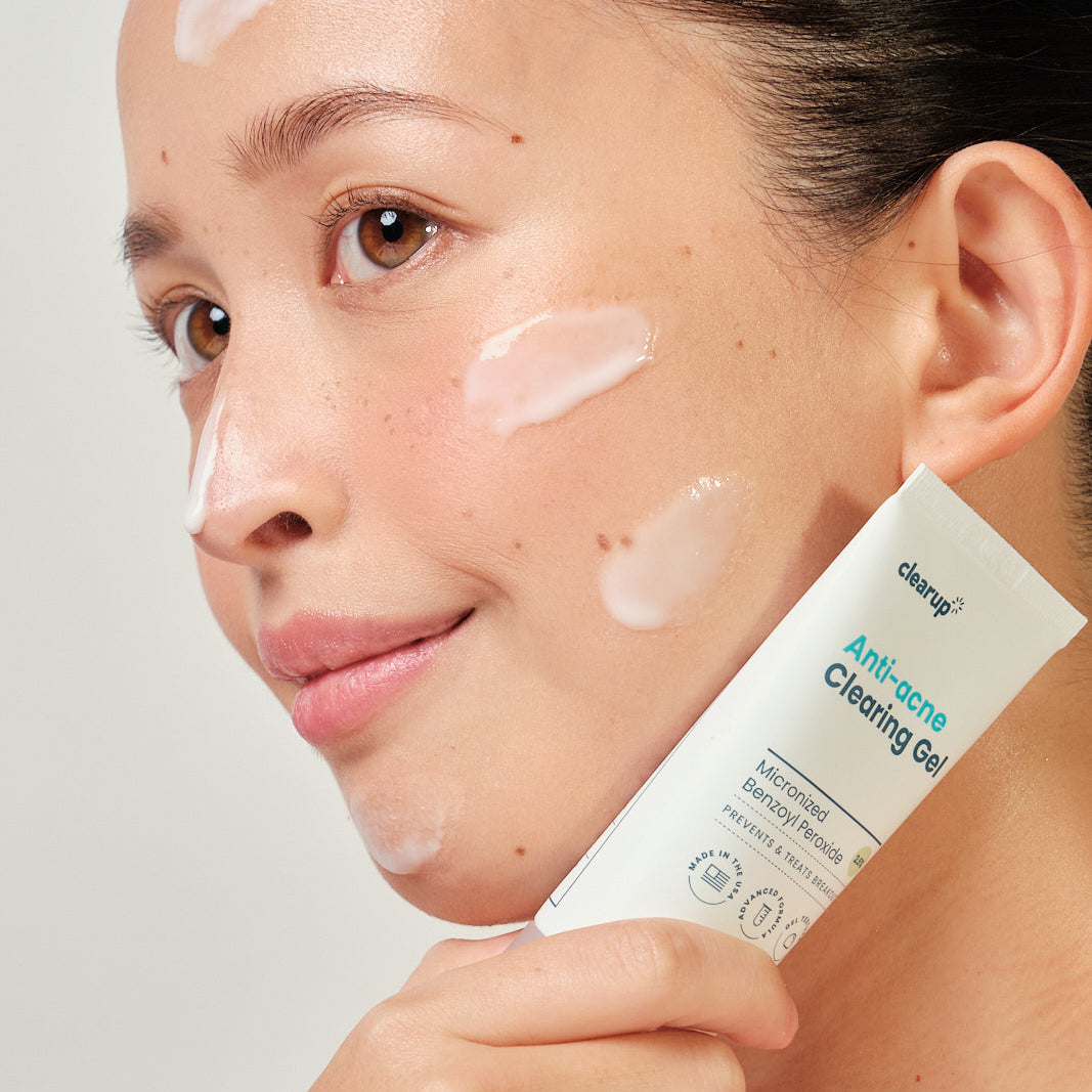 CLEARUP Clearing Gel Micronized Benzoyl Peroxide 2.5% 60g